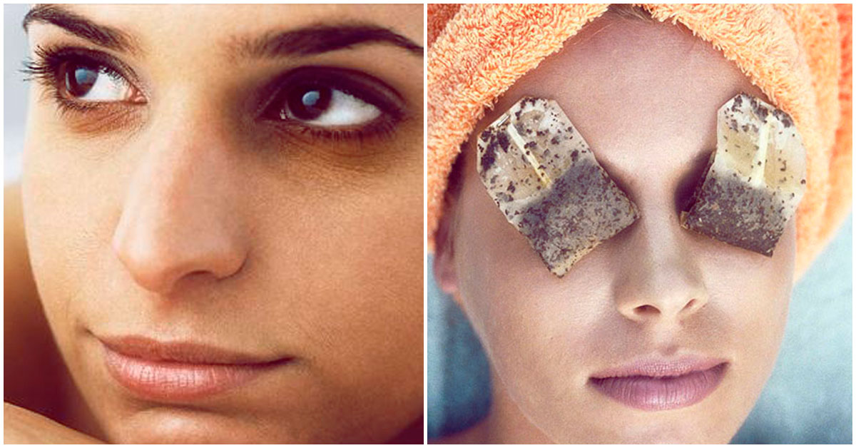 Remedios caseros para reducir las ojeras, ¡pruébalos!