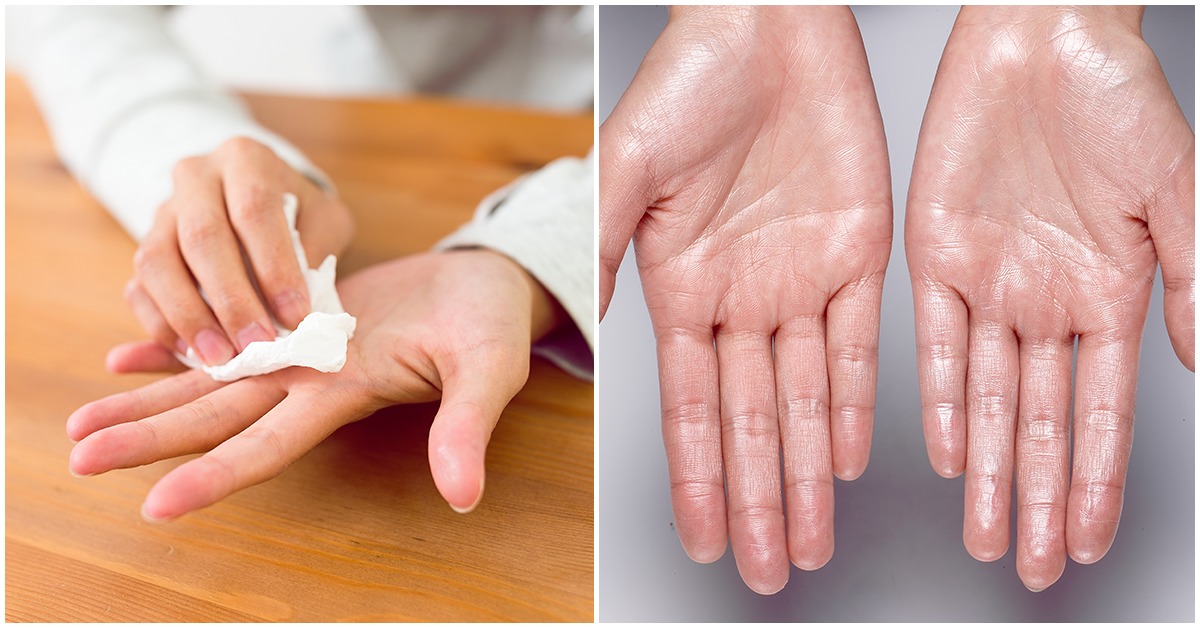 Ésta es la razón por la que tus manos sudan