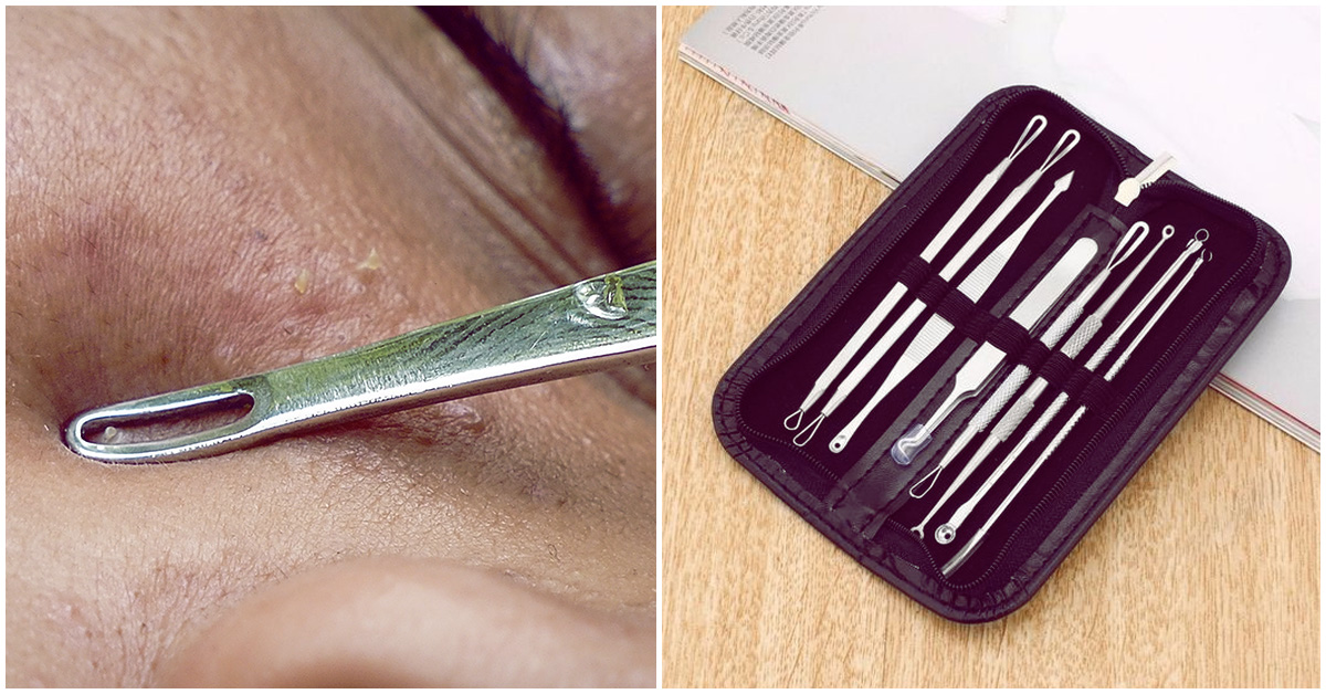 Todo lo que tienes que saber sobre los sacacomedones, antes de que compres uno